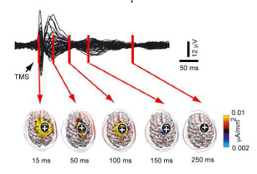 경두개 자기자극 유발전위의 전파를 시간에 따라 topographical map으로 보여준 그림