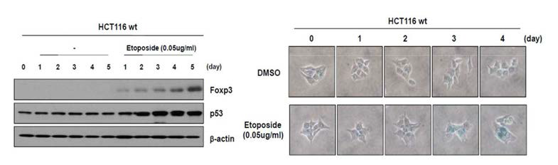 Etoposide에 의해 유도 된 노화시에 Foxp3의 발현 변화