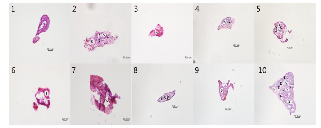 H&E staining results for 10 Os-NTSs. All of 10 NTSs have some sinuses as a substructure. Specimen ‘1’, ’3’, ‘6’, ‘7’, ‘9’ have single sinus. ‘2’ has 5 sinuses, ‘4’ has 2, 5 has 6, ‘8’has 4, ‘10’ has 15 sinuses. And All of Os-NTSs has clear boundary membrane.