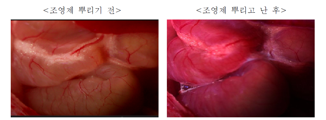 개발 조영제 전후 비교