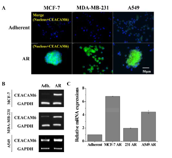 3종류 암세포의 AR 특성 유도 시 CEACAM6의 발현 여부 검증.