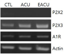 침자극 후 요추 4-6번의 DRG 조직으로부터 추출한 RNA에 대한 RT-PCR 결과
