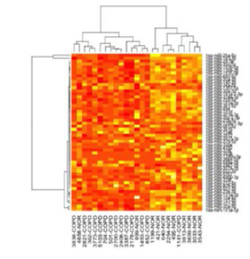 Heatmap of miRNA expression associated with COPD.