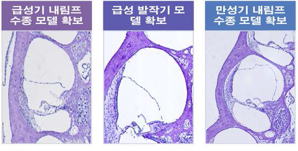 기니이픽의 내임파낭을 결찰하고 Vasopressin을 투여할 경우 급성기 및 만성기 내임프수종이 발생되며, 청력이 감소됨을 확인함