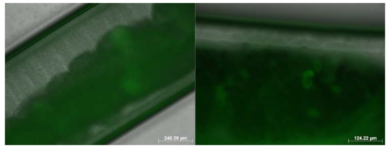 T. suis female 충체 내 충란 GFP 발현 (A: 100배, B: 200배)