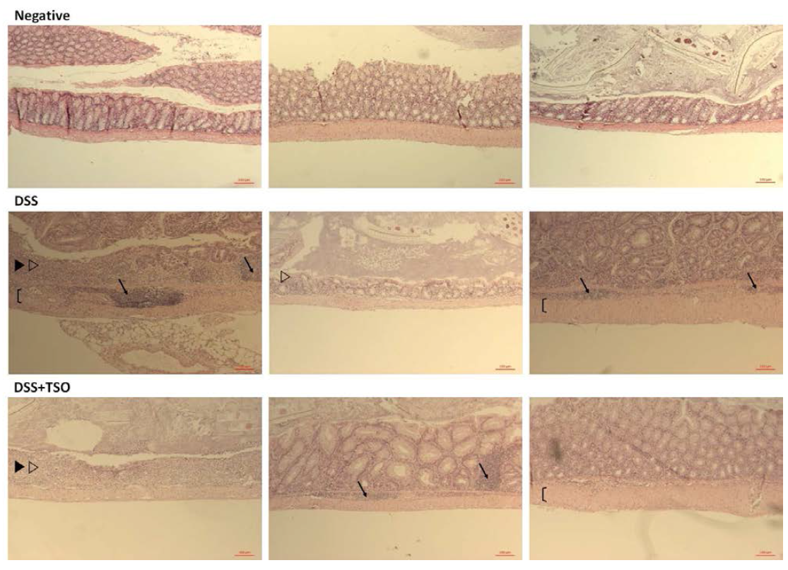 조직염색을 통해 대장 내의 면역세포 침윤 (→), 조직 파괴 (▶), 장벽의 부종 (〔), 그리고 음와의 손상 (▷)을 관찰