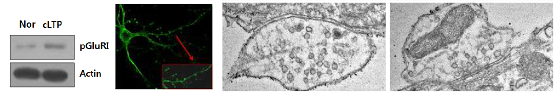 (좌) cLTP에 의한 pGluR1의 발현(western blot), (중간) cLTP에 의한 신경세포 형태적 변화(green), (우) 투과전자현미경으로 관찰한 대조군과 cLTP로 유도된 신경세포의 시냅스소포의 형태