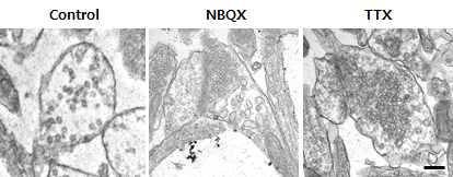 NBQX, TTX를 처리한 신경세포 시냅스소포의 미세구조.