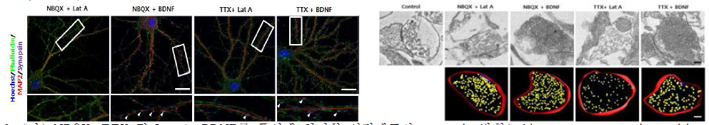 (좌) NBQX, TTX 및 Lat A, BDNF를 동시에 처리한 신경세포의 synapsin 발현(white arrow; synapsin positive signal) (우) NBQX, TTX 및 Lat A, BDNF를 동시에 처리한 신경세포 시냅스소포의 미세구조(위) 및 전자토모그램(아래). Bar=200nm