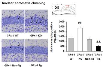 Dentate gyrus에서 TMT에 의 한 nuclear chromatin clumping이 GPx-1 KO mice에서는 유의하게 증가된 반면, GPx-1 Tg mice에서 는 유의하게 감소되었음