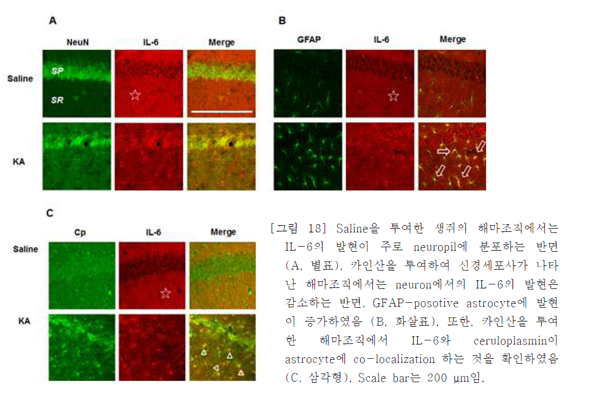 Saline을 투여한 생쥐의 해마조직에서는 IL-6의 발현이 주로 neuropil에 분포하는 반면 (A, 별표), 카인산을 투여하여 신경세포사가 나타 난 해마조직에서는 neuron에서의 IL-6의 발현은 감소하는 반면, GFAP-posotive astrocyte에 발현 이 증가하였음 (B, 화살표). 또한, 카인산을 투여 한 해마조직에서 IL-6와 ceruloplasmin이 astrocyte에 co-localization 하는 것을 확인하였음 (C, 삼각형). Scale bar는 200 μm임.