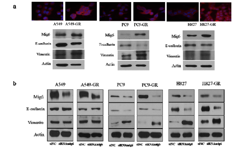 Knockdown of Mig-6 induced overexpression of vimentin in gefitinib resistant cell line