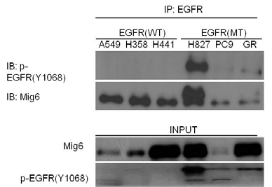 내성세포주 PC9 GR에서 p-EGFR과 Mig 6의 interaction이 증가