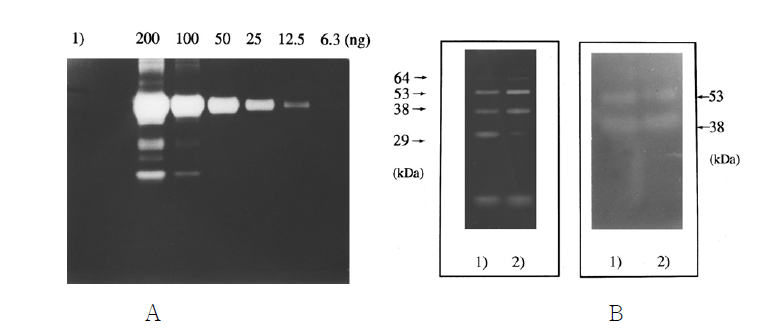 혈전용해효소인 plasmin을 자이모그라피 기술에 적용 (A)과 된장으로부터 분리한 두 종류의 Bacillus 균주의 zymography 기술에 적용 (B)