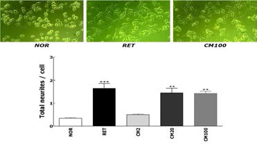 Phase-contrast photomicrographs of CM-induced neurite outgrowth in Neuro2A mouse neuroblastoma cells.