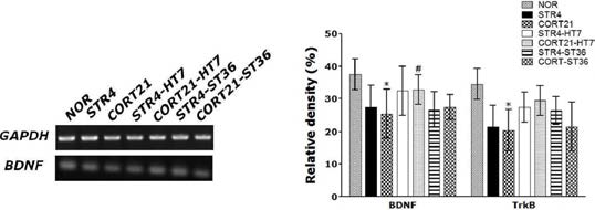 스트트레스 농도와 처리시간에 따른 BDNF 및 TrkB mRNA의 발현량에서 신문혈의 효능 비교