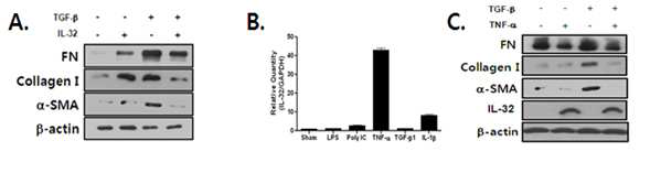 폐섬유아세포 내 IL-32γ 의 TGF-β 유도 ECM 생성 억제