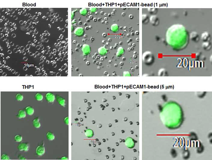 암세포(THP-1)/자성비드 구조체의 공초점 현미경 사진