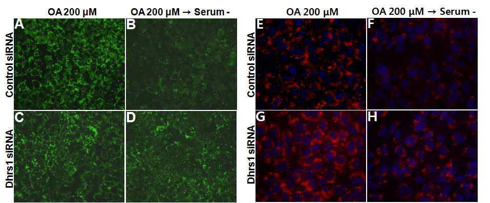 The effect of Dhrs1 on lipid droplet formation in mammalian cells