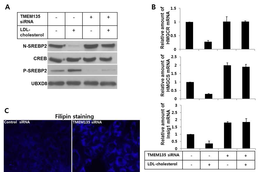 The effect of TMEM135 RNAi on intracellular cholesterol transport