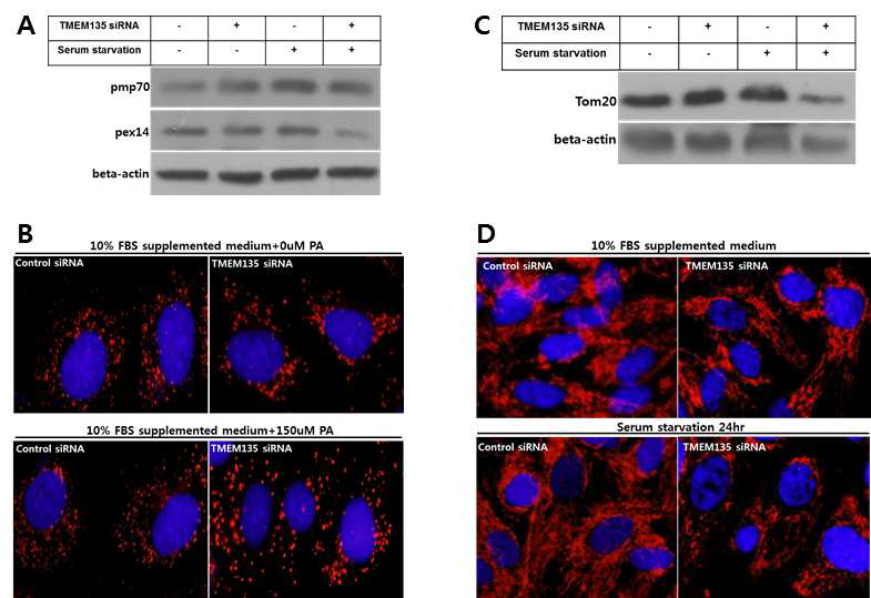 The effect of TMEM135 RNAi on peroxisome and mitochondria function