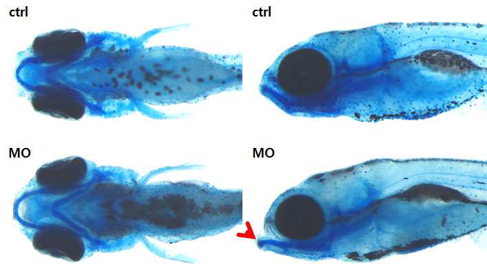 The effect of TMCO1 knockdown on zebrafish development