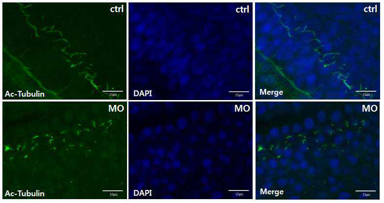 The effect of TMCO1 knockdown on zebrafish development