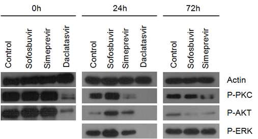 소포스푸비르, 시메프레비르 및 다클라타스비르의 세가지 약제를 처리한 후 immunoblotting을 시행하였고, 시메프레비르를 처리하였을 때 24시간 이후 PKC와 Akt의 인산화가 감소되어 유지됨을 확인 할 수 있었다