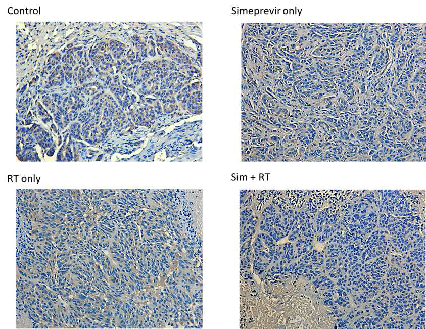 immunohistochemical staining of PI3K􌩃. 시메프레비르 및 방사 선치료 병합군에서 PI3K􌩃의 발현이 감소함을 확인하였다.