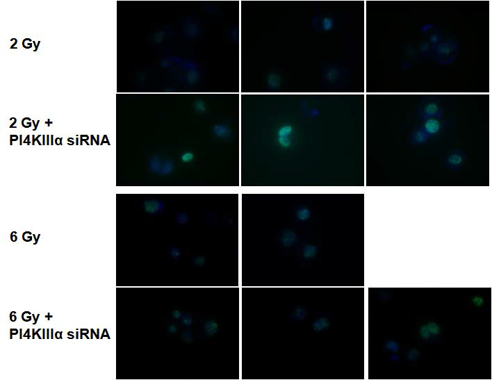 인체유래 유방암 세포주에서 siRNA를 통하여 PI4K III􌩀를 억제한 후 방사선을 조사하였을 때 􌩂H2AX foci가 prolongation되는 것이 확인되었다