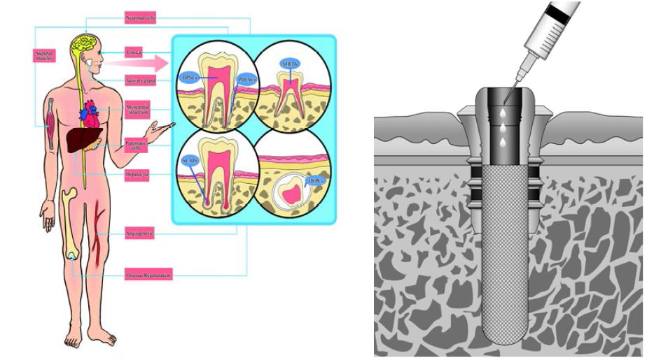 OsseoGate의 Stem cell culture & delivery 모식도