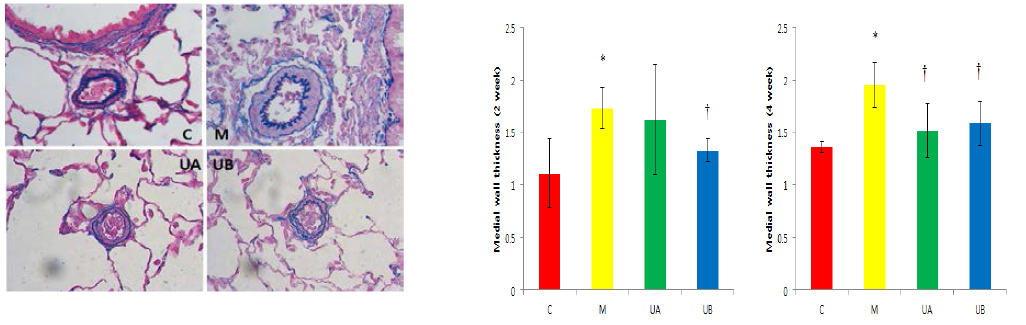 Changes of medial thickness of pulmonary arteriole.