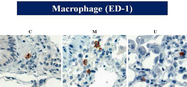 Expression of macrophage.