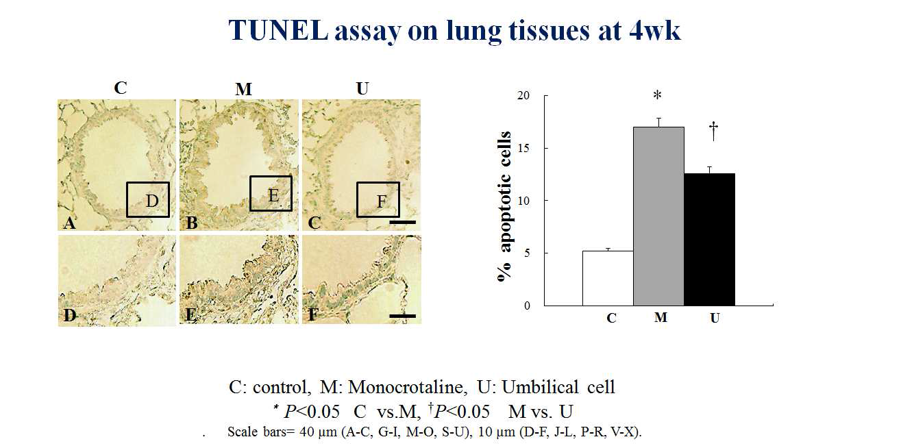 TUNEL assay on lung tissues at week 4.