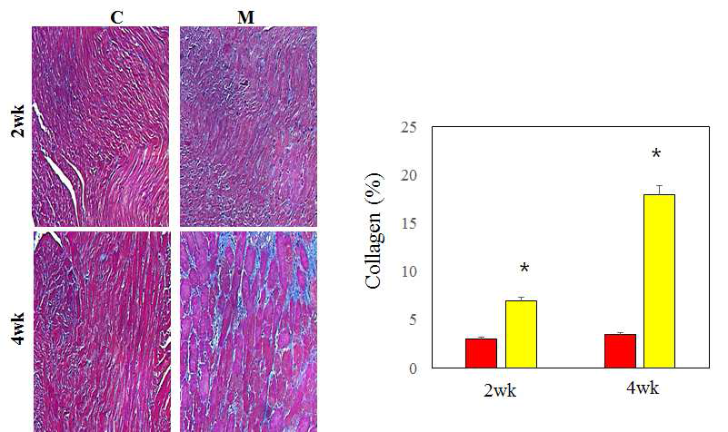 Changes of collagen content by Masson trichrome staining