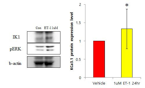 ET-1 induced PASMC proliferation