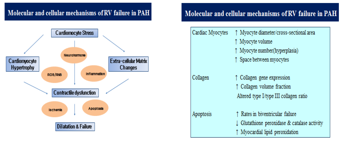 Melecular and cellular mechnism of RV failure in PAH.