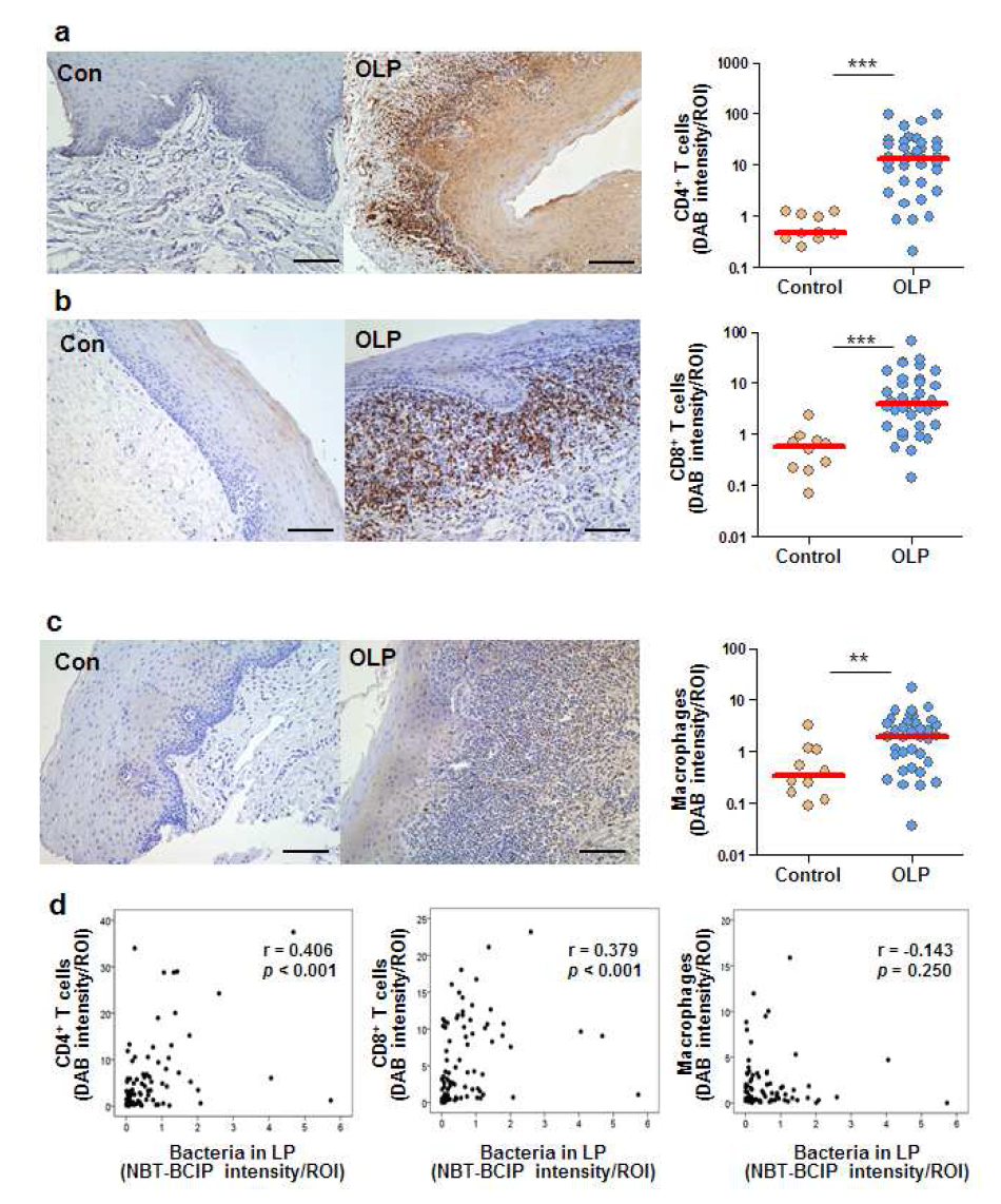 구강편평태선 병소 고유층에 침투한 세균과 T 림프구 침윤 간의 관계 대조군 또는 구강편평 태선 점막조직 절편을 CD4 (a), CD8 (b), 대식세포 (c)에 대한 항체로 염색하고 ImageJ 프로그램으 로 정량하였다. d. 구강편평태선 병소조직 고유층에서 관찰된 세균양과 각 면역세포 양간의 상관관계 를 Spearman􍾨s rank correlation test로 검증하였다.