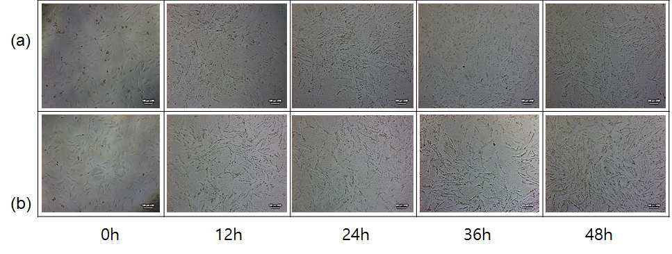 약물전달체 자체와 약물이 담지된 약물전달체의 처리시간에 따른 섬유아세포의 현미경 이미지