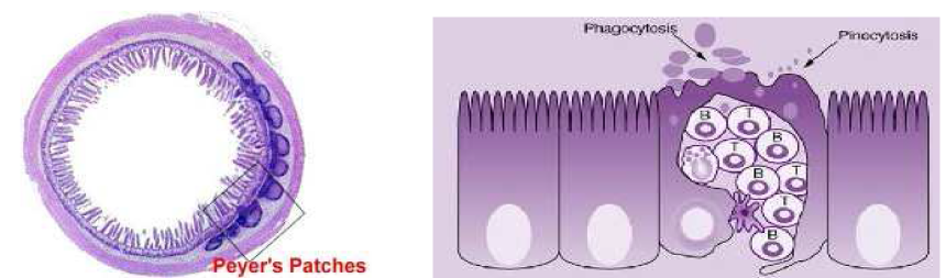 Peyer's patches(좌)와 그 안에 존재하는 M cell의 구조(우)