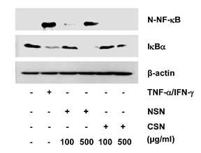 Keratinocyte TNFα/INFγ 자극모델에서 NF-κB 활성 평가