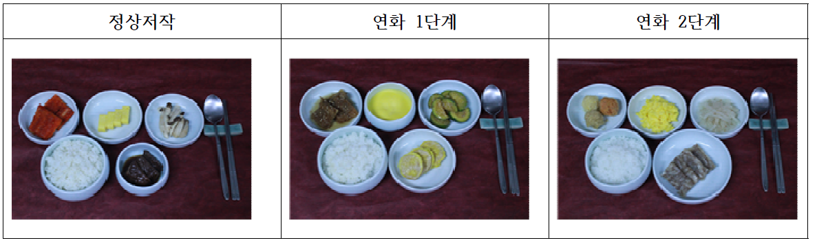 같은 재료를 사용하여 chef recipe로 물성을 3단계로 조절한 정상식이와 연화 1단계/ 연화 2단계 식단의 예