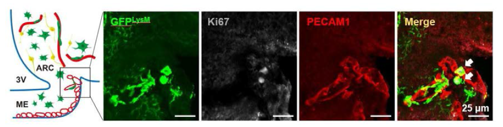 Ki67을 이용한 meningeal/perivascular macrophage의 proliferation 확인