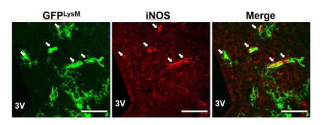 HFD를 한 동물의 시상하부에서 LysM/GFP 세포와 iNOS의 공동염색