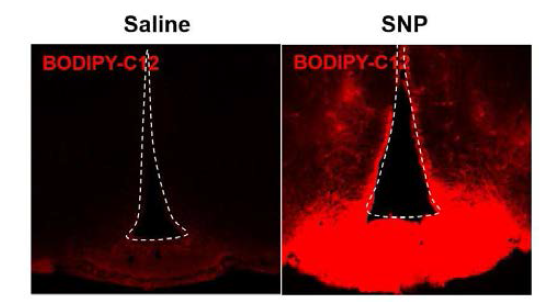 5일간의 SNP (1 ug) daily ICV injection에 의한 MBH vascular permeability 분석