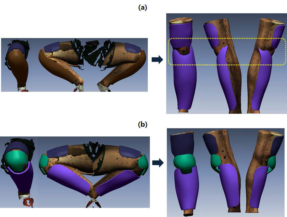 The two-part leg guard(thigh, knee+shin) from the 120􌜿 knee flexion posture