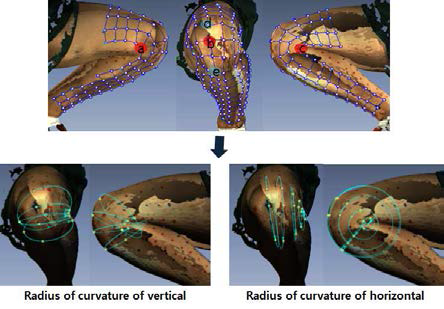 Three points for the radius of curvature measurement (Example of knee)