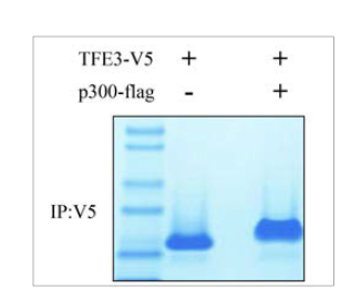 TFE3 단백 분리