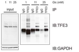포도당 농도에 따른 TFE3 단백 확인