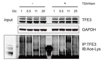 Deacetylase 억제제 처리에 의한 TFE3 단백 변화